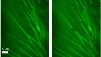Fig. 1: Cutting of a single fiber within a living bovine endothelial cell. The pretensioned fiber snapps back and gives thus conclusions about the mechanic stability within the cell. The diameter of the fiber is < 1 µm.