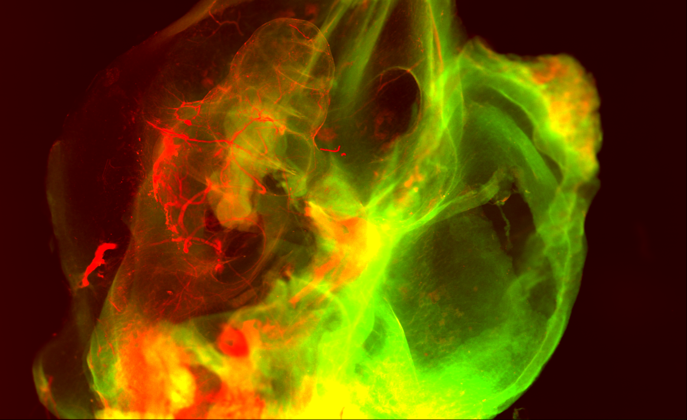 Bild 3: Zum ersten Mal stellt das LZH auf der LASER World of PHOTONICS die Scanning Laser Optical Tomography vor. (Foto: LZH)