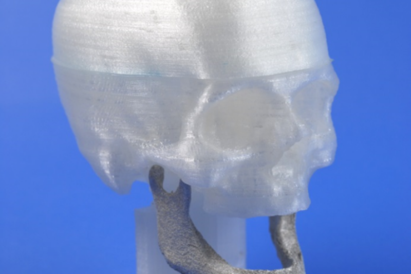 Figure 1: Individual magnesium implant, manufactured by optimized Selective Laser Melting (SLM). (Photo: LZH)