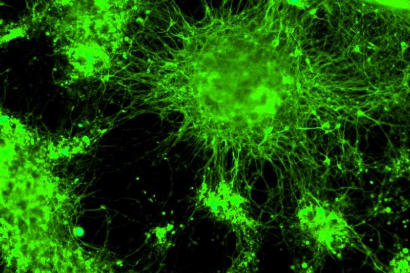 Figure 1: GNOME laser transfection can continuously achieve high vitality rates of over 80% in primary cells (here: cortical neurons) (Photo: LZH)