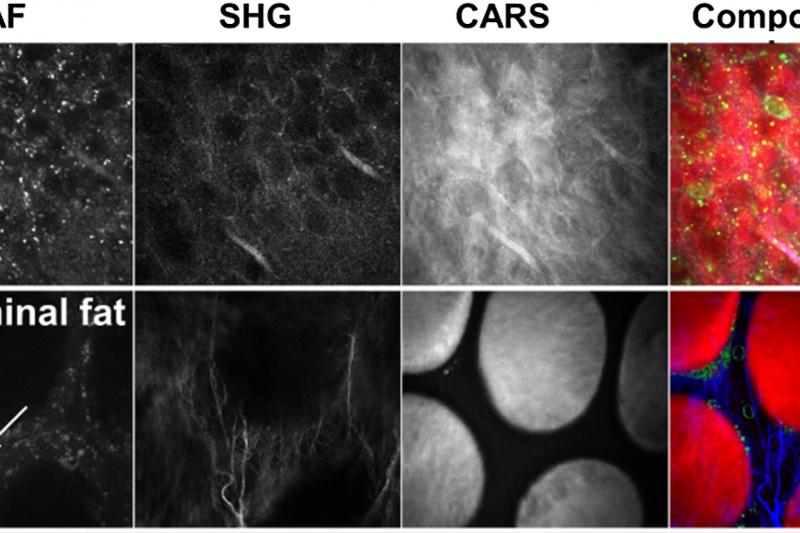 A typical overlay of different imaging methods. Within the EU-project CARMEN scientist and companies work on combining three imaging methods in a novel multimodal imaging system. (Graphic from J. of Medical Imag-ing, 2(1), 016003 (2015))