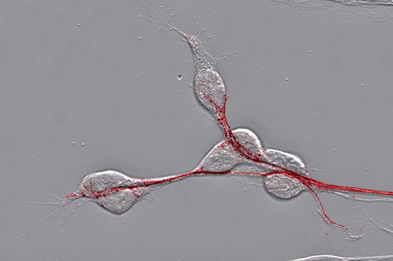 Figure 1: Migrating pioneer neurons under the phase contrast microscope, selectively stained by a fluorescence dye (red). (Photo: TiHo)